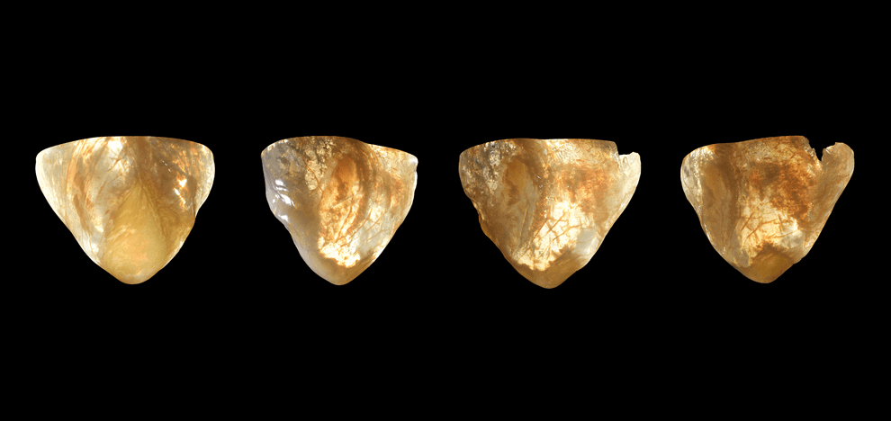 improved-diagnostics-presurgical-planning-high-resolution-functionally-graded-multi-material-3d-printing-biomedical-tomographic-datasets-5 improved-diagnostics-presurgical-planning-high-resolution-functionally-graded-multi-material-3d-printing-biomedical-tomographic-datasets-5